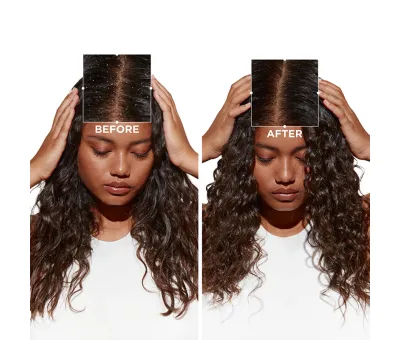 L'Oréal Kérastase Symbiose Bain Crème Anti-Pelliculaire